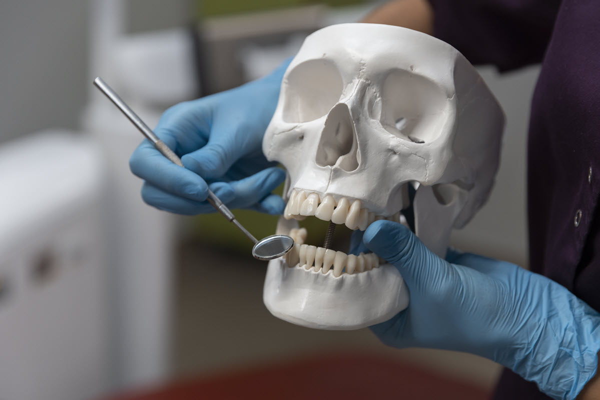 Before Full Upper Arch Implant Restoration