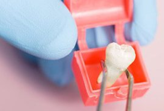 Before Zirconia Anterior Crowns